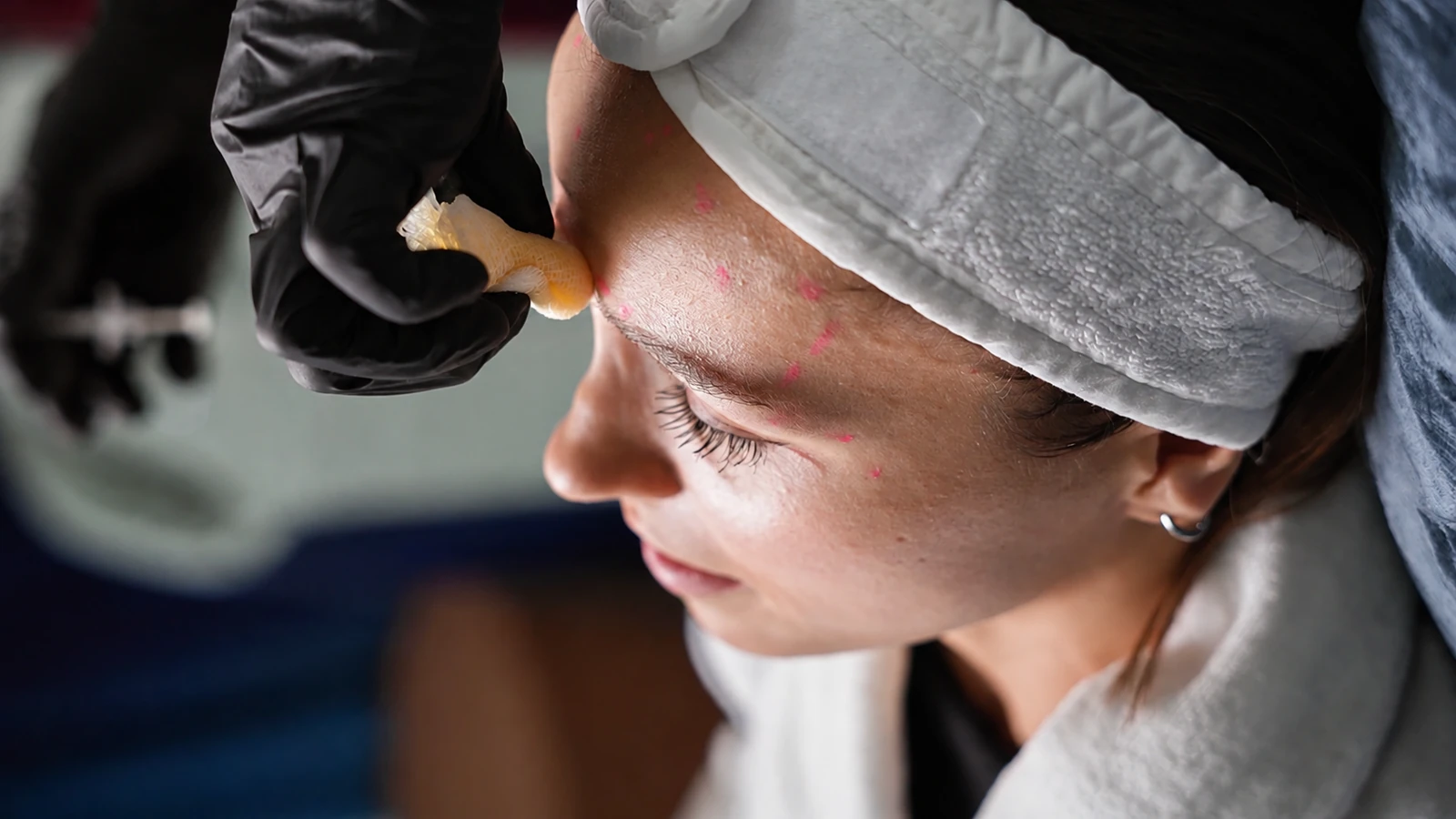 AI-enhanced illustration of a clinician applying a swab to a patient's forehead during treatment